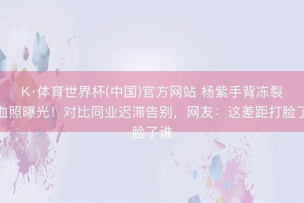 K·体育世界杯(中国)官方网站 杨紫手背冻裂渗血照曝光！对比同业迟滞告别，网友：这差距打脸了谁